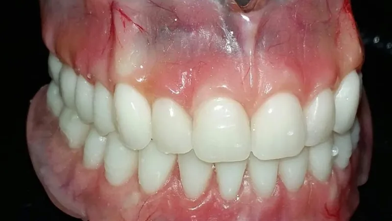 Odontoverse Dental Clinic & Implant Center