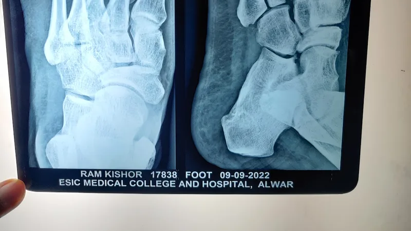 Dr Mohit Agarwal (Bone & Joint OPD) Clinic