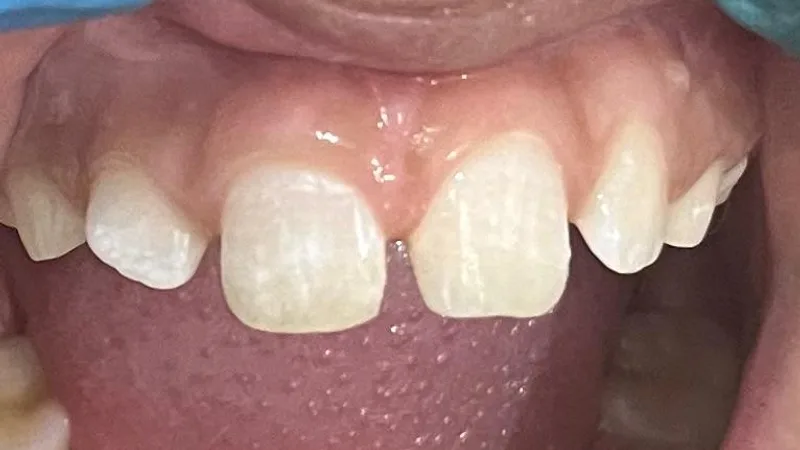 Khandelwal Dental Hospital -Aesthetic and Implant Centre - (Dental implant)