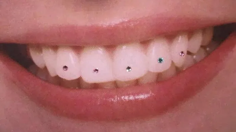 JOSHI DENTAL HOSPITAL "Implants & Braces Center"