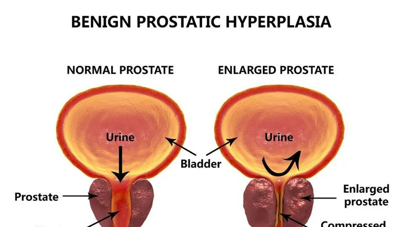 LIGO KIDNEY STONE & UROLOGY HOSPITAL