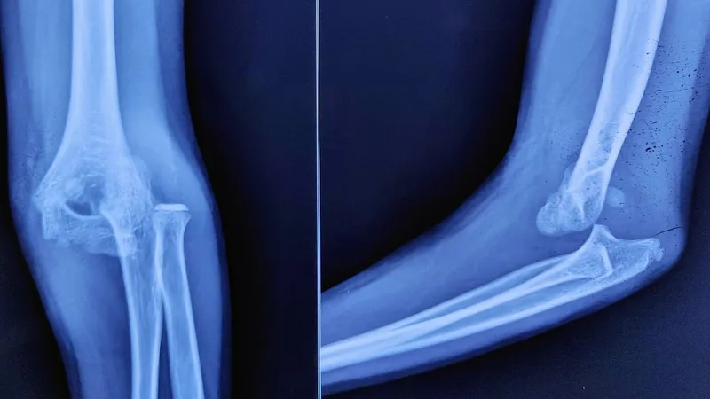 NARESH ORTHO & SPINE CLINIC & MITHUNA FAMILY CLINIC MOGAPPAIR, CHENNAI