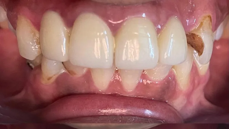 Dhasaa dental clinic- Ambattur - MAXILLOFACIAL CENTRE