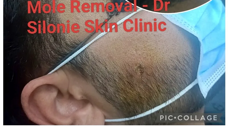 Dr Silonie Skin and Laser Clinic (USA trained, Appointment compulsory .Best Botox / Fillers / Laser) Clinic