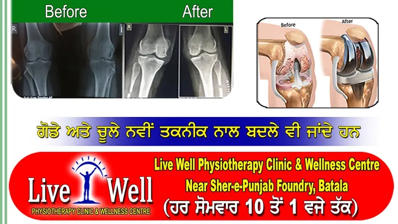 Dr HP SINGH Joint Replacement Surgeon Clinic