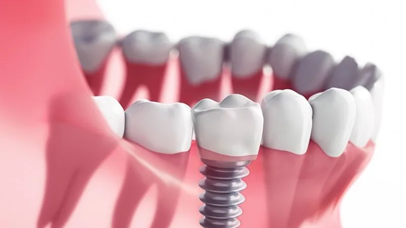 Kalsi Dental Clinic