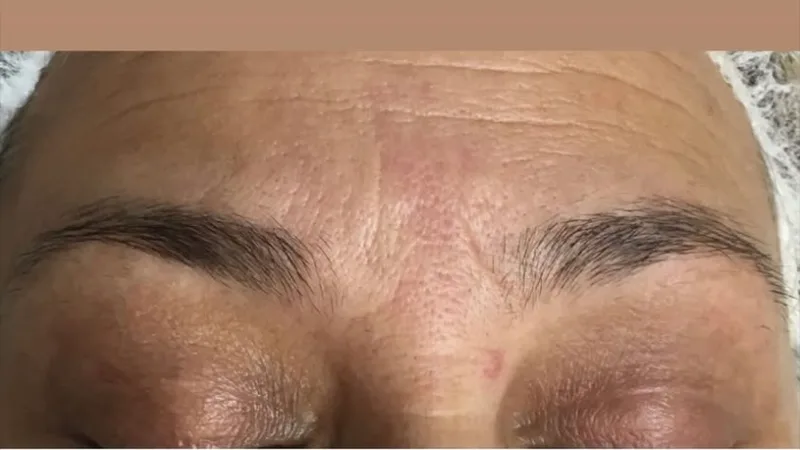 Dr R.K.Sokhi,s DERMA WORLD Clinic