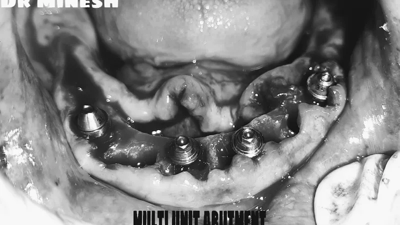 Dr Minesh Patel's 32 Dental Care Clinic