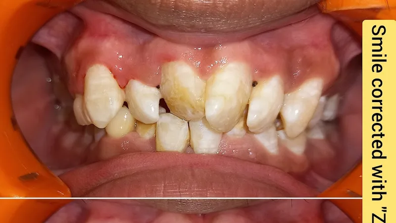 Dental House and Implant Dental Clinic -Best Dentist in Anand |Best Dental Clinic in Anand |Best Dentist in Vidyanagar