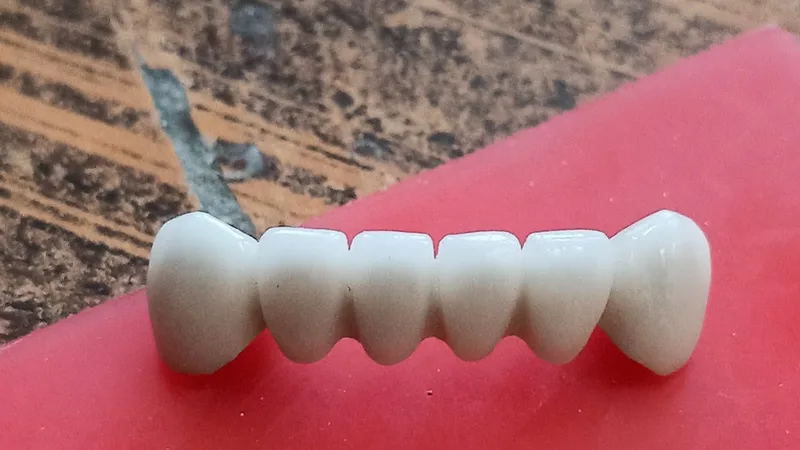 GR DENTAL LAB