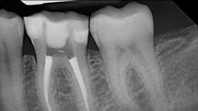 Advanced Dental Clinic