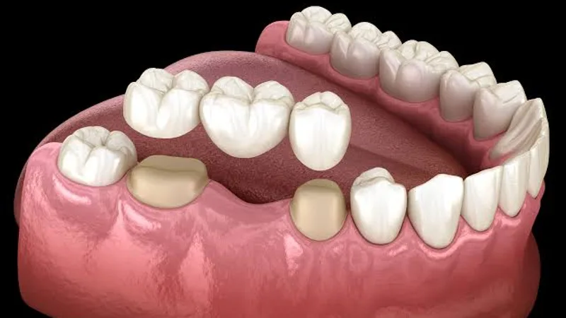 Accure Oral And Dental Clinic (Dr. Saurabh Vishwakarma)