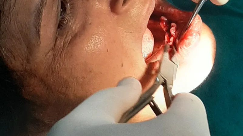 Elite Dental Care | Dentist in Ara