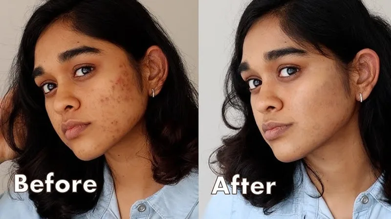 Mahavir skin and smile aesthetic studio , Dr Vaibhaw jain BDS ( FMSC) , Dr Amit K Yadav (pmch) MDS, Dr Rashmi ( MDS OMFS)