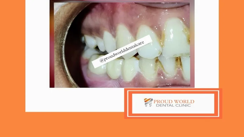 PROUDWORLD DENTAL CARE -BEST DENTAL CLINIC IN BURNPUR,ASANSOL
