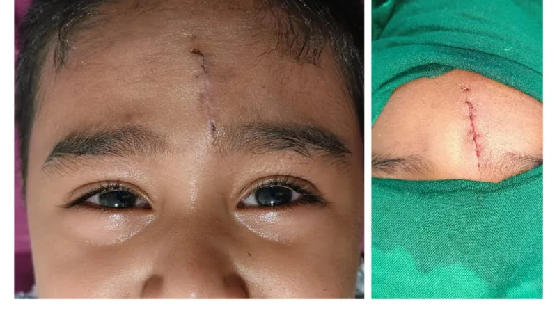 Dr Ritabrata Mukhopadhyay : Plastic Surgeon and Trauma Reconstruction in South Kolkata Clinic