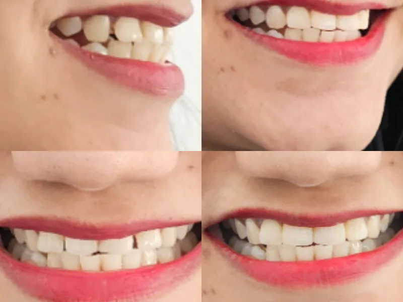 Ashwini Dental Clinic