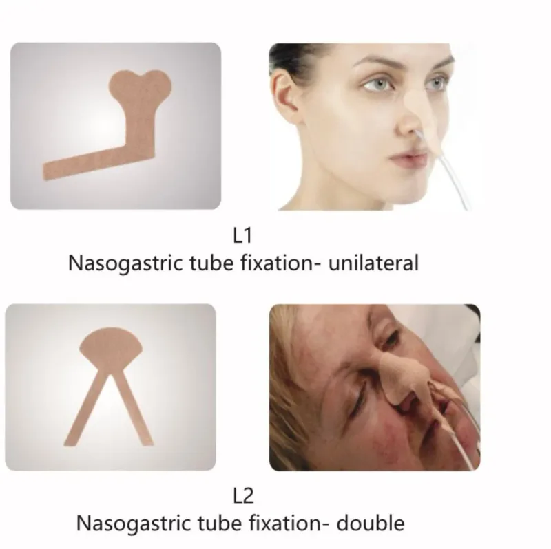 Velfix Secure- Nasogastric Tube Fixation